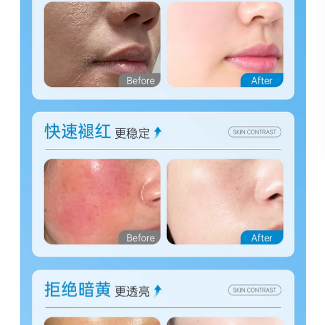 B5积雪草爽肤水补水保湿敷收缩毛孔舒缓精华修护肤化妆水男女正品