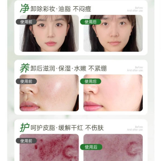 黑茶卸妆油女官方旗舰店正品牌水乳液膏温和深层清洁脸眼唇敏感肌