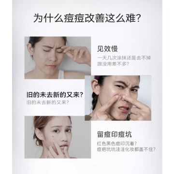 DEVA活动专享祛痘产品D2痘痘精华液淡化组合