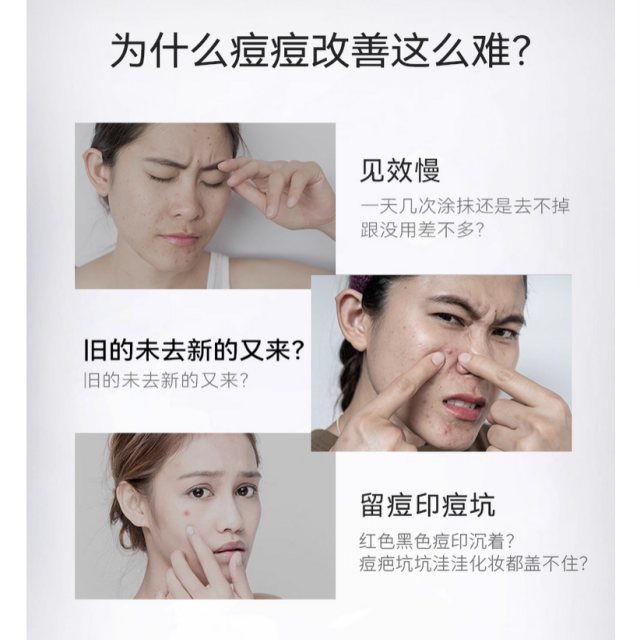 DEVA活动专享祛痘产品D2痘痘精华液淡化组合