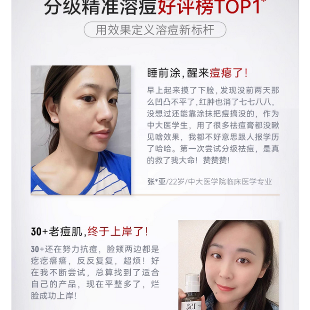 DEVA活动专享祛痘产品D2痘痘精华液淡化组合